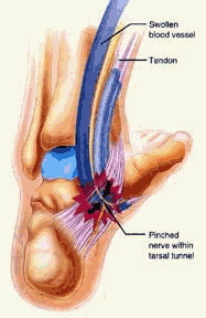 Podatry Ankle Pain Diagram